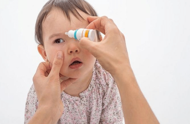 علاج حساسية العين للاطفال الرضع