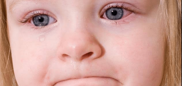كيفية علاج حساسية العين عند الاطفال 