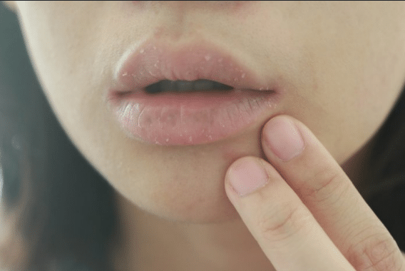 أسباب جفاف الفم وطرق علاجه