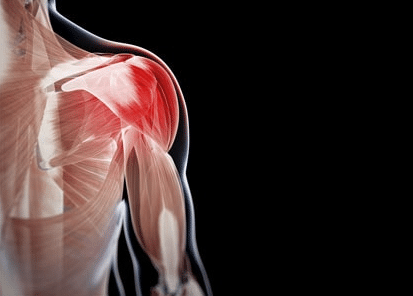 كيفية علاج إلتهاب العضلات عند الرجال