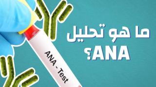 المقصود بتحليل ANA والهدف منه