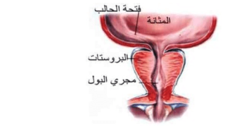 علاج تضخم البروستاتا عند الشباب