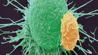 رعاية مرضى السرطان في ظل “فيروس كورونا”