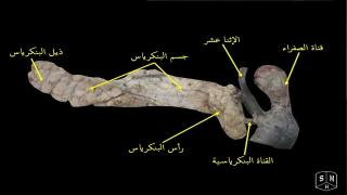 التهاب البنكرياس