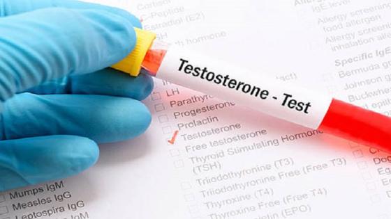 نسبة هرمون التيستوستيرون الطبيعية