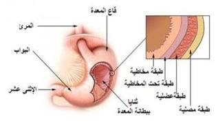 أعراض التهاب المعدة