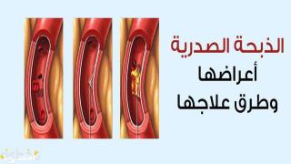 أعراض الذبحة الصدرية