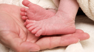 تقشر جلد الأطفال حديثي الولادة
